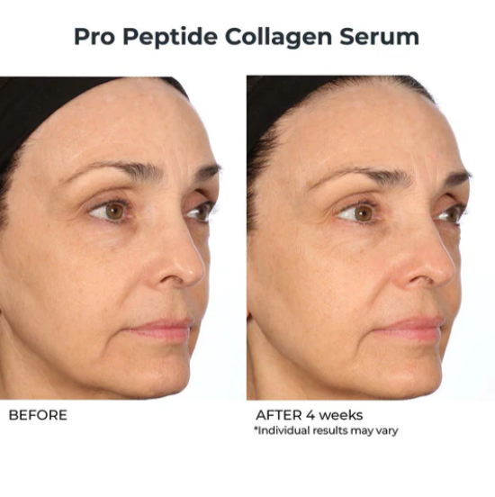 Even, Correct and Firm Duo