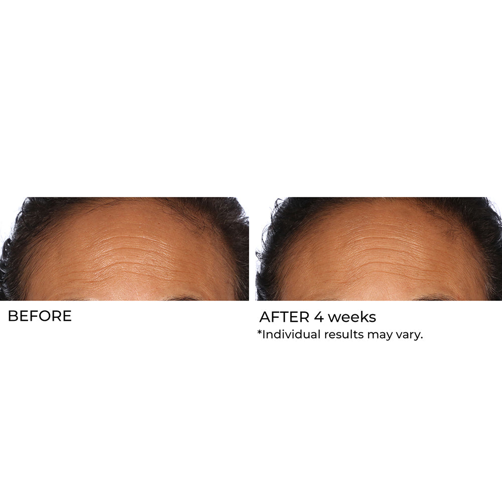 Hydro-Gel