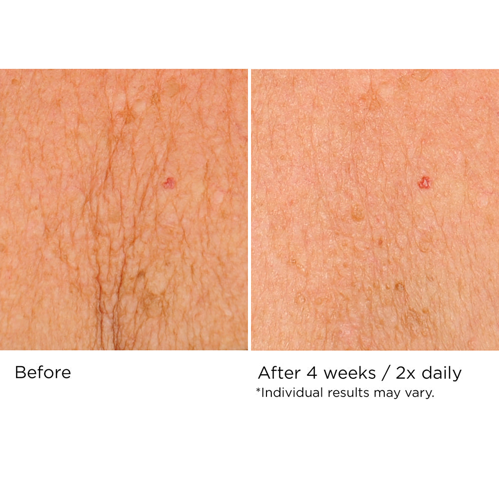 Deco-Lift Neck Firming & Lifting Complex