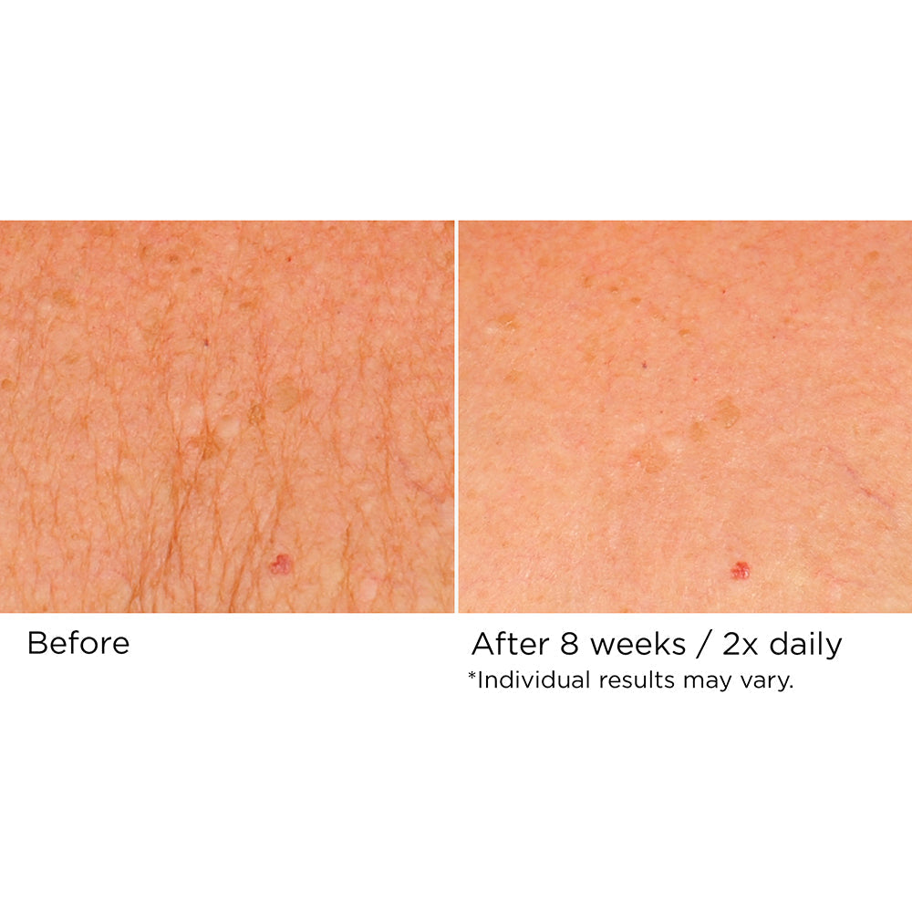 Deco-Lift Neck Firming & Lifting Complex