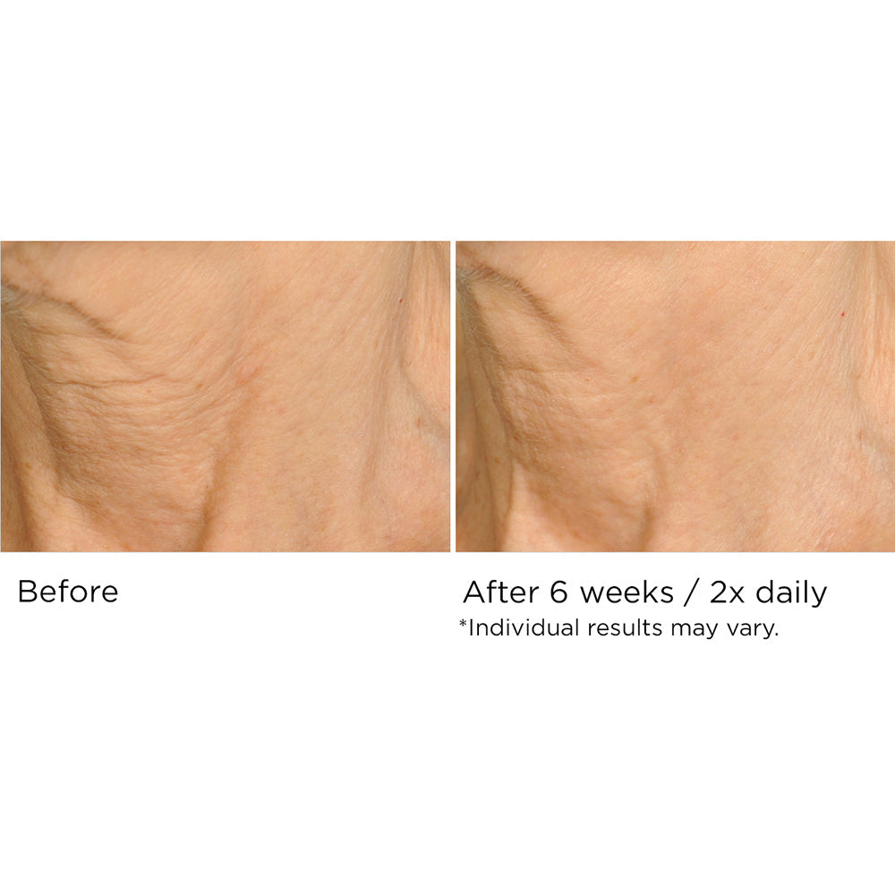 Deco-Lift Neck Firming & Lifting Complex