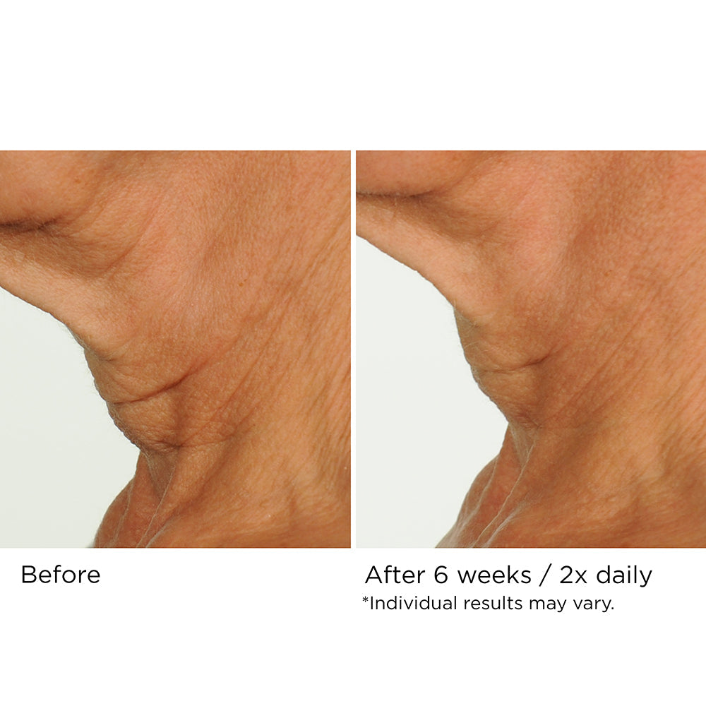 Deco-Lift Neck Firming & Lifting Complex