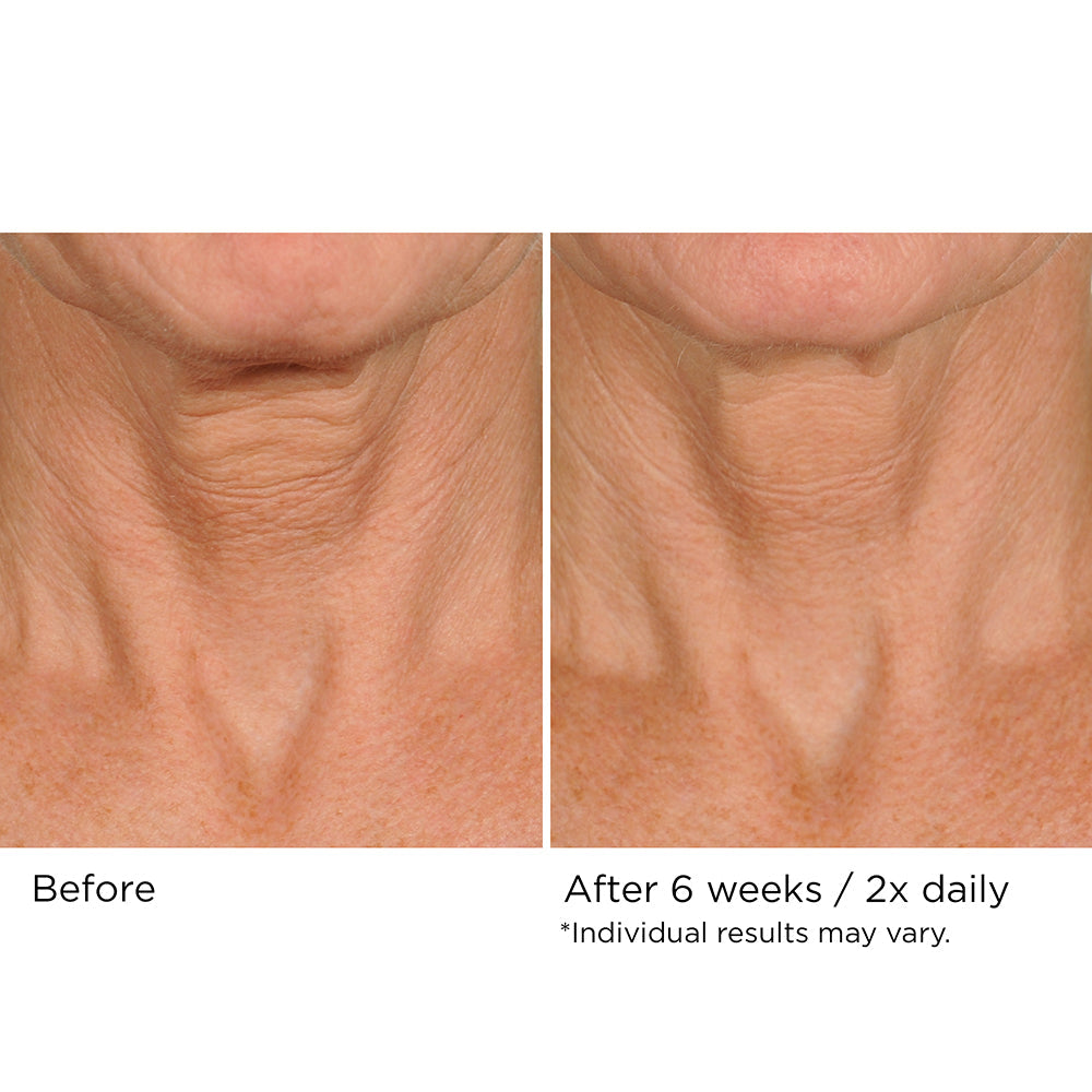 Deco-Lift Neck Firming & Lifting Complex