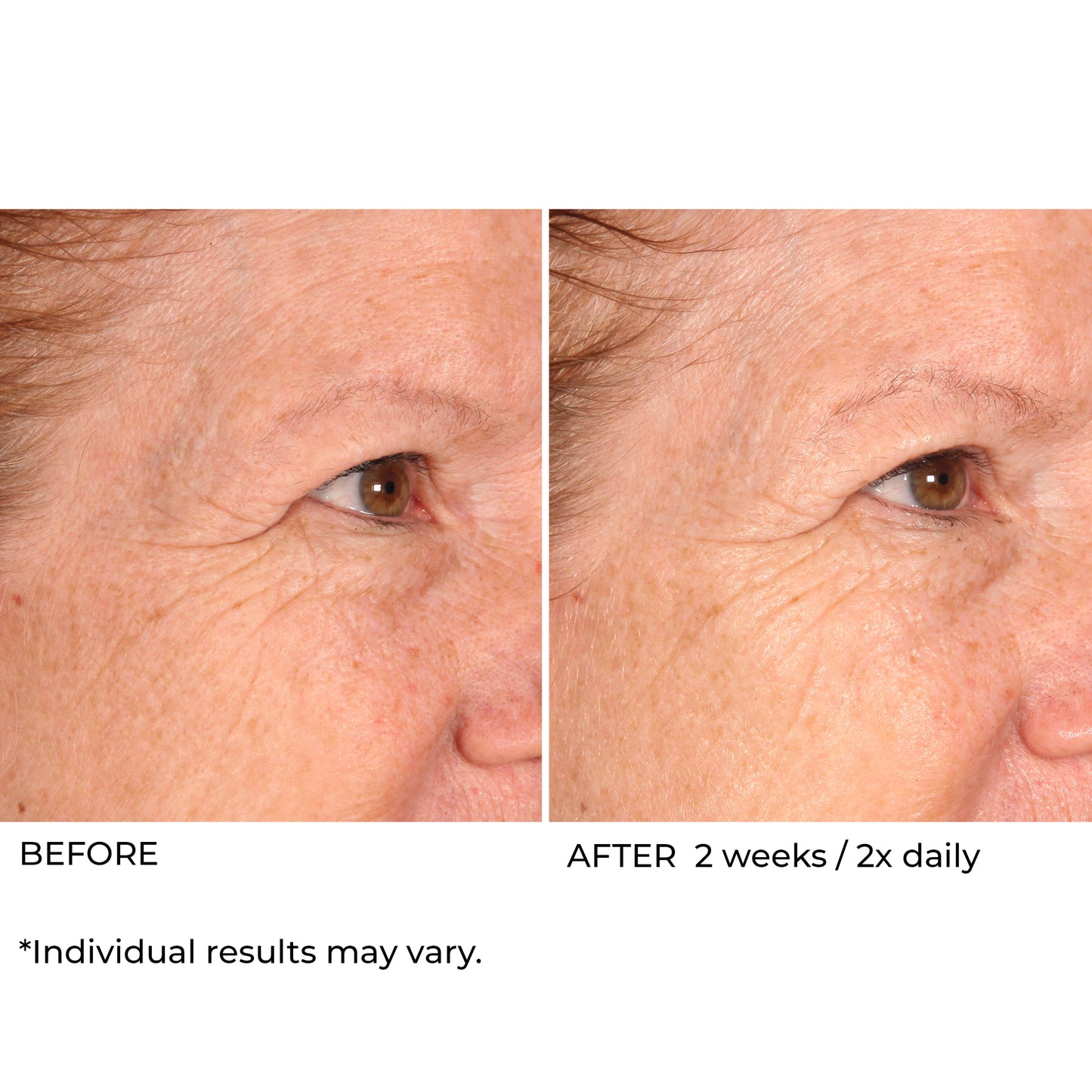 Hydro-Screen® Intense Hydration Face & Body Soufflé