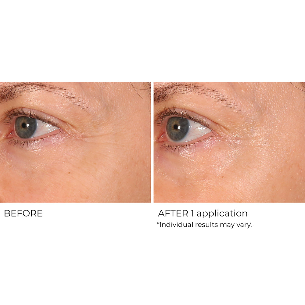 Wrinkle Blur Targeted Treatment