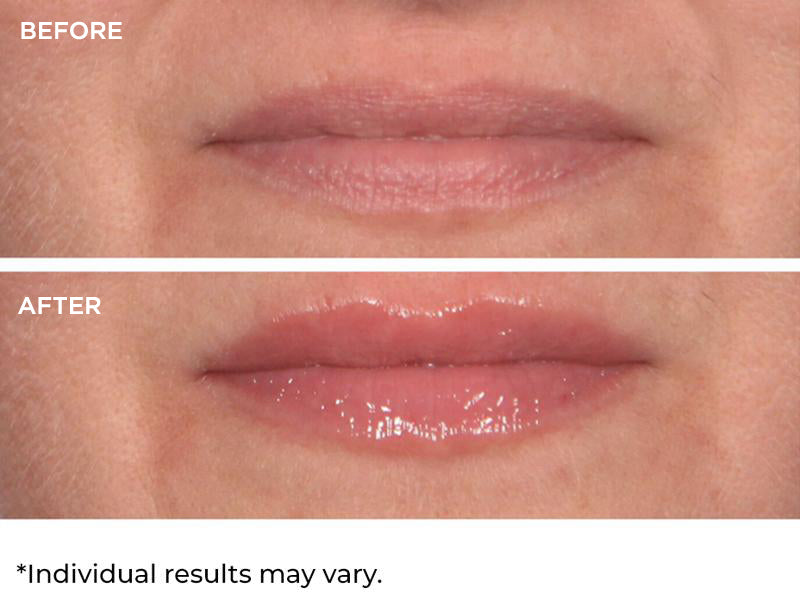 Hydro-Screen For Lips