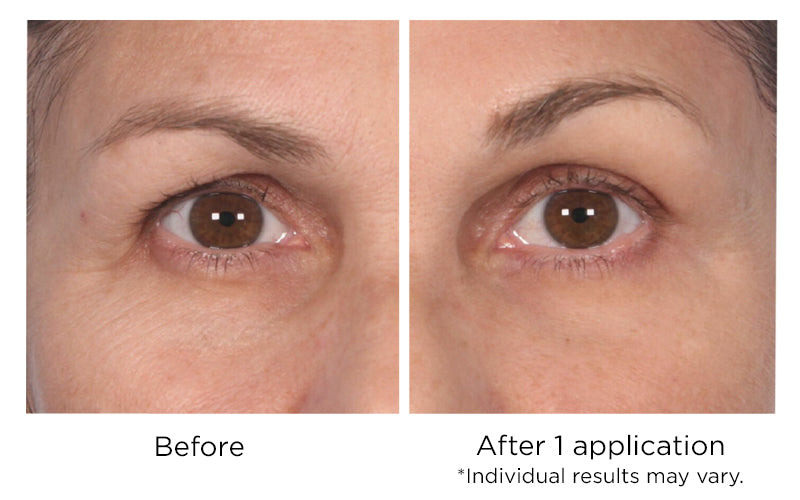 Quickfix Wrinkle Reducing Serum