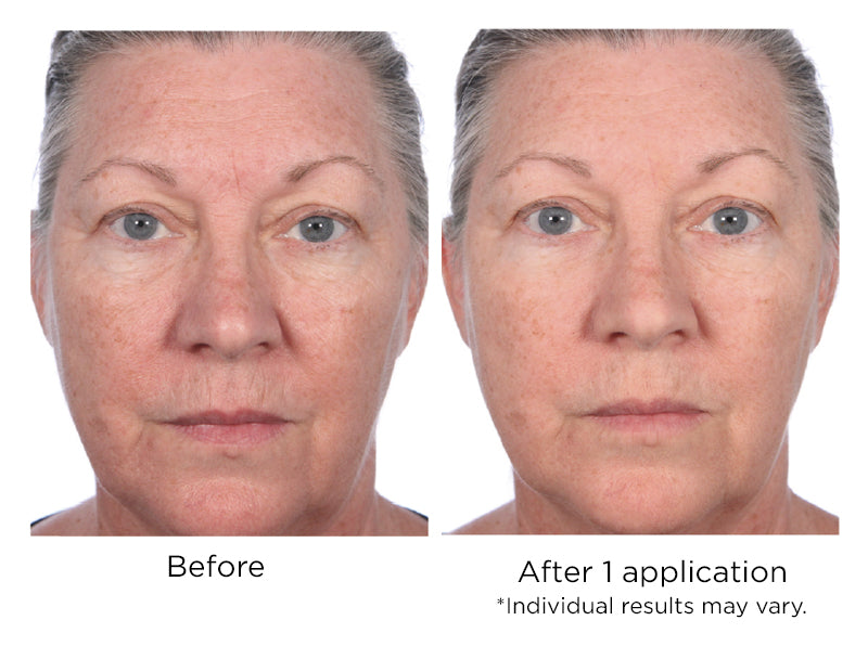 Quickfix Wrinkle Reducing Serum