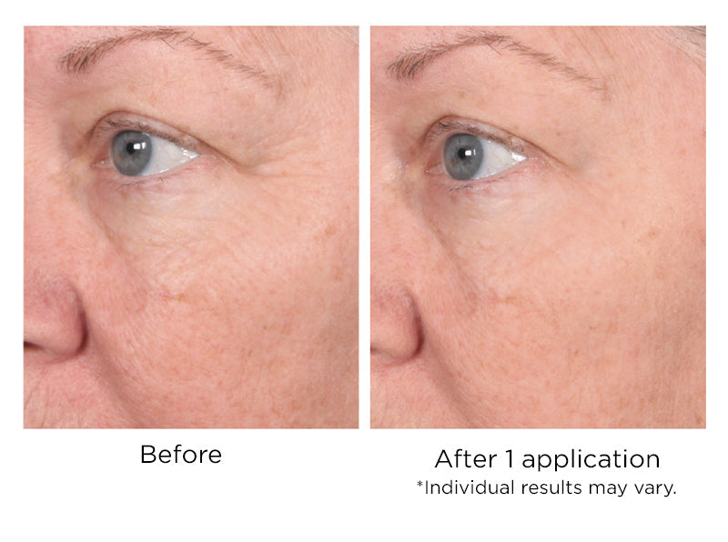 Quickfix Wrinkle Reducing Serum