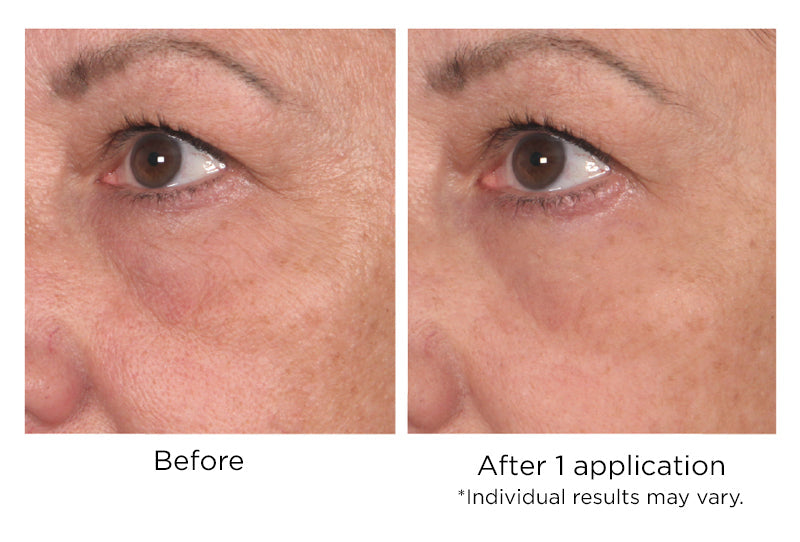 Quickfix Wrinkle Reducing Serum