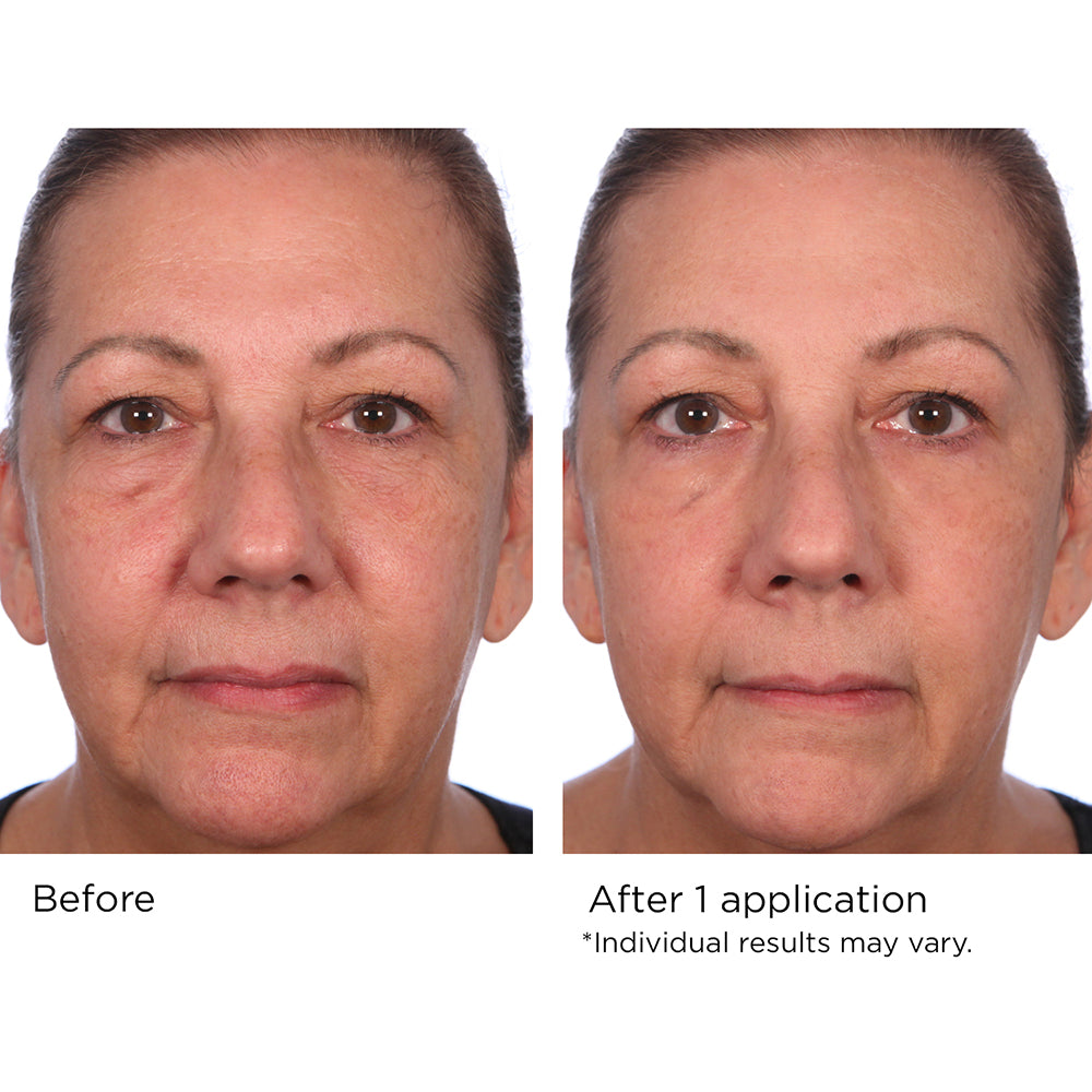 Quickfix Wrinkle Reducing Serum