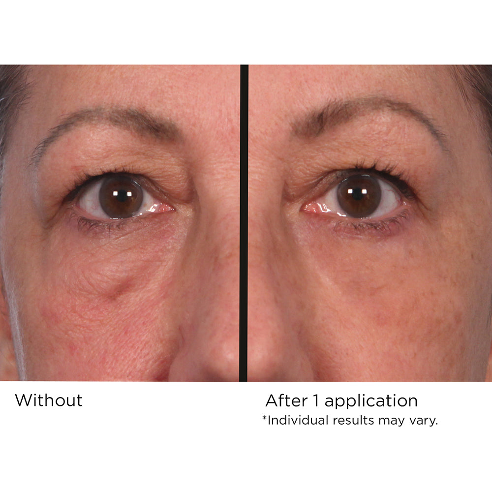 Quickfix Wrinkle Reducing Serum
