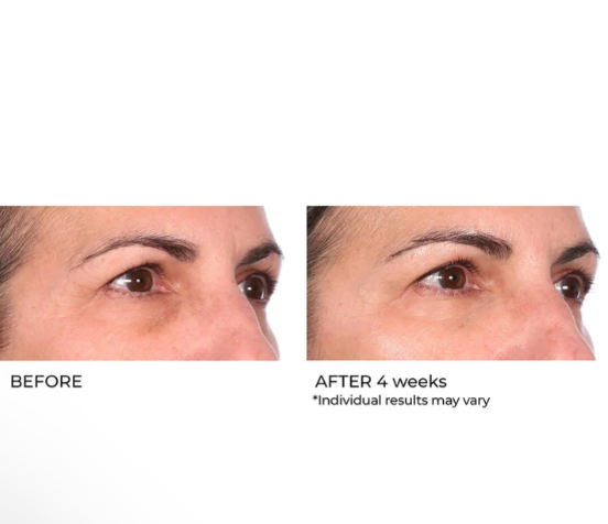 Niacinamide Biopeptide Serum