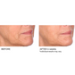 Niacinamide Biopeptide Serum