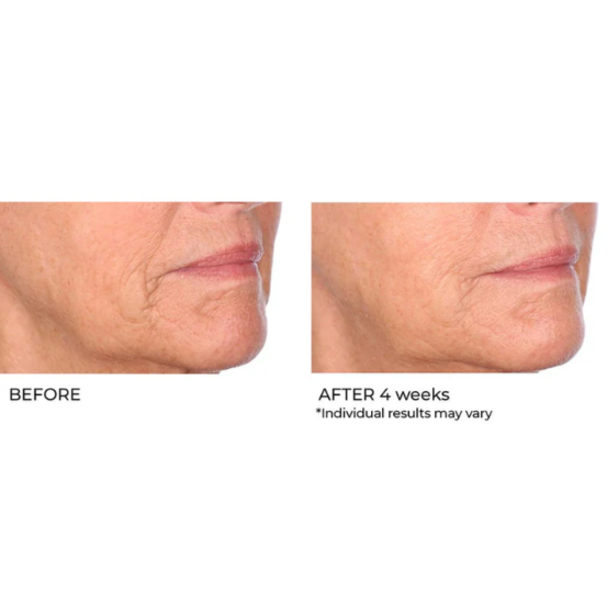 Niacinamide Biopeptide Serum