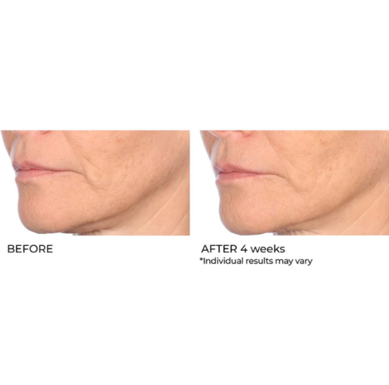 Niacinamide Biopeptide Serum