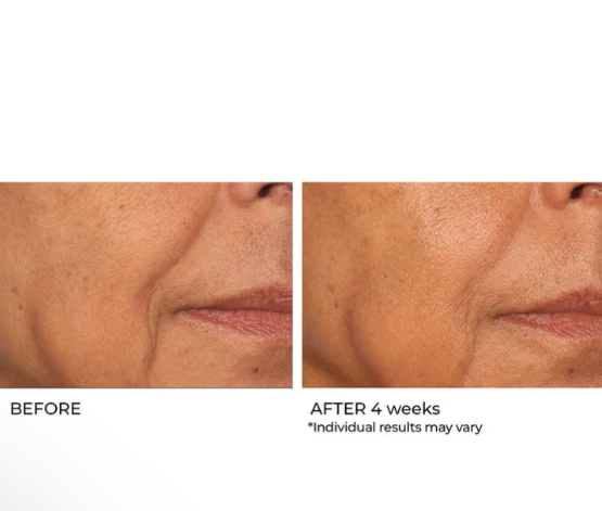 Niacinamide Biopeptide Serum
