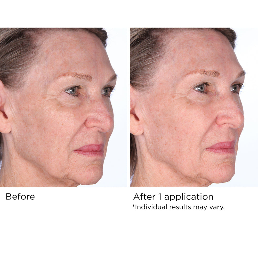 Quickfix Face and Neck Lift