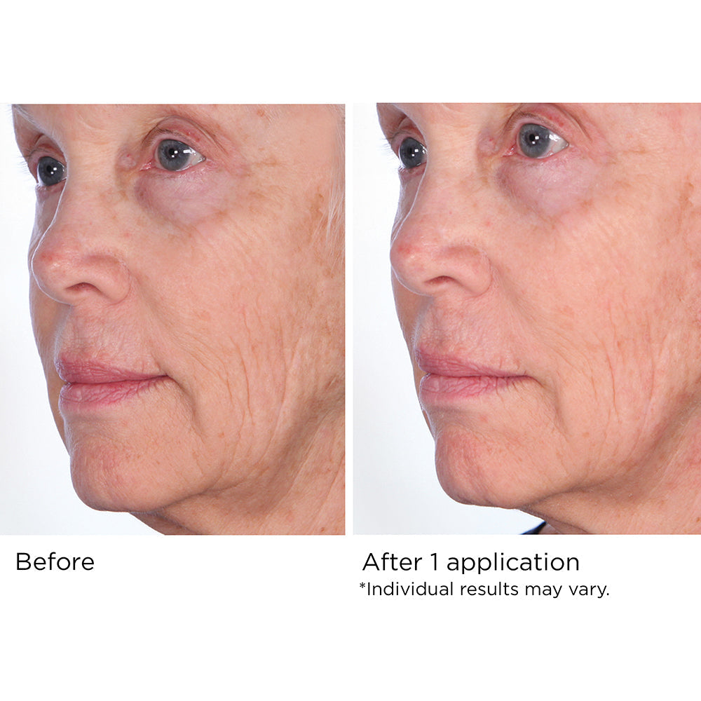 Quickfix Face and Neck Lift