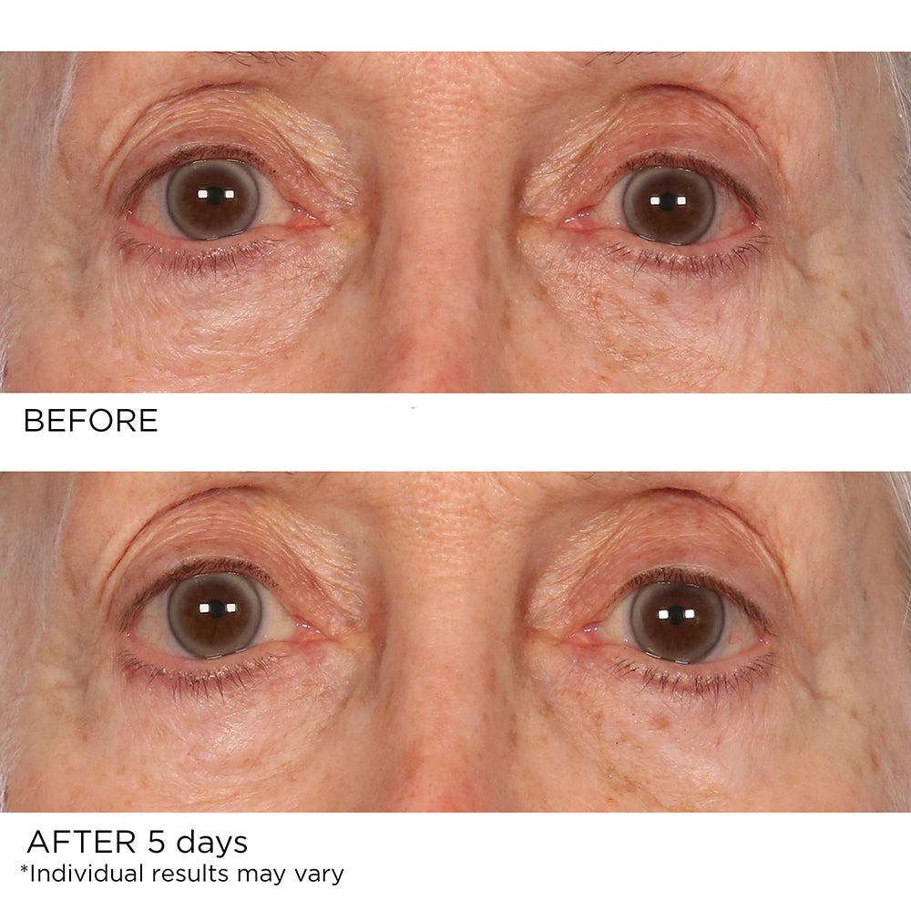 Age Defying Eye Renewal Serum