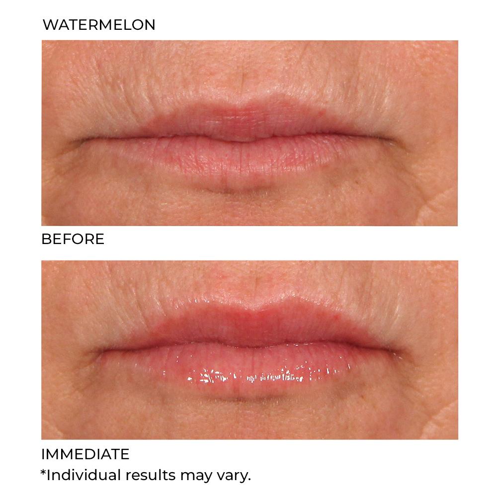 Hydro-Screen For Lips