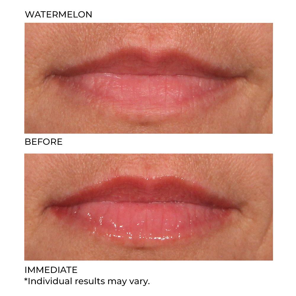 Hydro-Screen For Lips