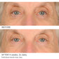 Under Eye Smoother