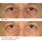 Under Eye Smoother