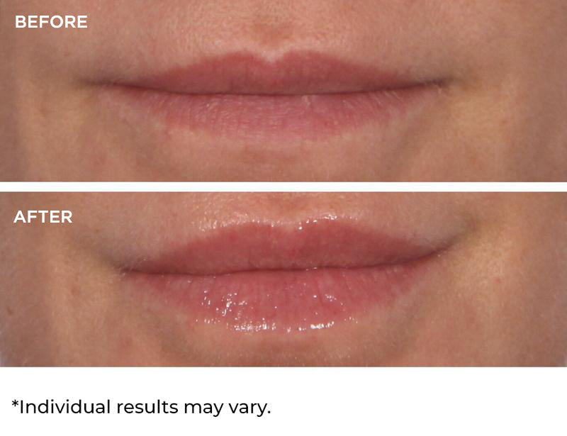 Hydro-Screen For Lips