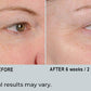 Peri-Orbital Eye Complex, Revitalizing and Regenerating Cream