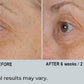 Peri-Orbital Eye Complex, Revitalizing and Regenerating Cream