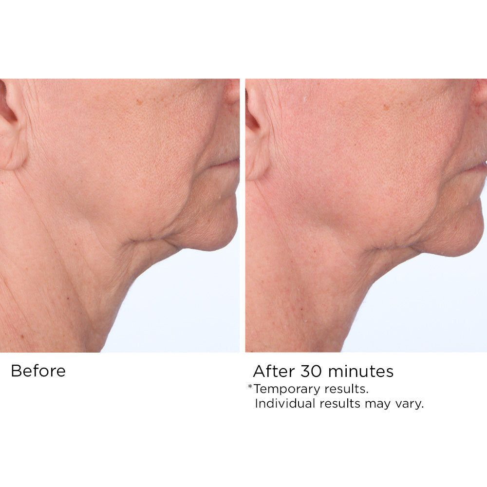 Quickfix Face and Neck Lift