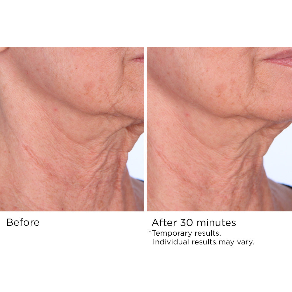 Quickfix Face and Neck Lift